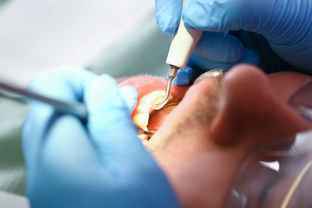 Best Urgent Dental Care for Toothache in Stowell, TX